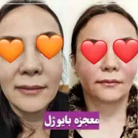 فقط بایوفیلر