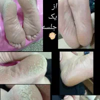 پدیکور پا