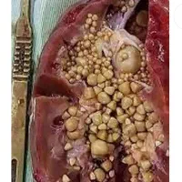 خدمات طب سنتی جهت بهبودودفع سنگ کلیه دراسرع وقت