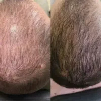 زیبایی رو به خودت هدیه بده
