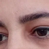 ریمو تخصصی تاتو صورت