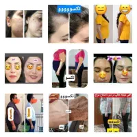 لاغری طبیعی وبدون رژیم