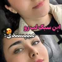 ژل،بوتاکس،فیلربادی باسن بیکینی،پی ارپی زاویه سازی|خدمات زیبایی و سلامت|تبریز, |دیوار