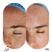 زیبایی ،پوست ،جراحی|خدمات آرایشگری و زیبایی|سهند, |دیوار