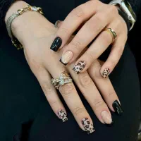 کاشت اولیه فقط ۱۴۹