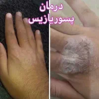 مشاوره رایگان