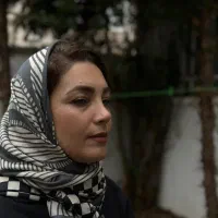عمل بینی 25میلیون