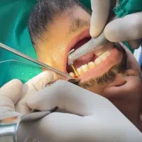 دندانپزشکی اقساطی بدون بهره|خدمات آرایشگری و زیبایی|کرج, کوی کارمندان شمالی|دیوار