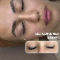 ریمو پاک کردن خط چشم وابرو دریک جلسه