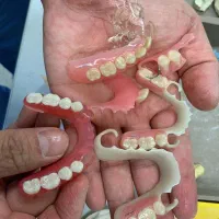 ساخت انواع دندان مصنوعی