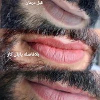 سالن تخصصی میکروپیگمنتیشن و زیبایی|خدمات آرایشگری و زیبایی|زابل, |دیوار