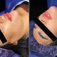 اندام رویایی تو، با هزینه‌ای مناسب توسط پزشک