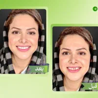 جشنواره ایمپلنت تاشب یلدافقط/۷۹۰۰