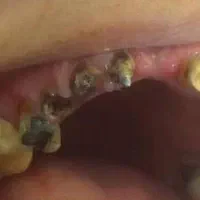 خدمات دندانپزشکی  با  قیمت و شرایط پرداخت عالی|خدمات آرایشگری و زیبایی|رشت, دروازه لاکان|دیوار