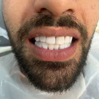 دندان پزشک  با تجربه  نیازمندیم