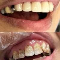 تخفیف به مناسبت افتتاحیه مطب|خدمات آرایشگری و زیبایی|اصفهان, خواجو|دیوار