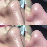 فشیال پوست رفع لک در مطب زیبایی .بانوان -اقایان|خدمات آرایشگری و زیبایی|شیراز, رازی|دیوار