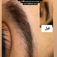 ریموو تک جلسه  با تخفیف ویژه|خدمات آرایشگری و زیبایی|تربت جام, پاسداران|دیوار