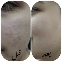 انواع سرم|آرایشی، بهداشتی، درمانی|شیراز, باجگاه|دیوار