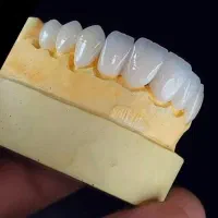 ایمپلنت عصبکشی ترمیم کشیدن|خدمات آرایشگری و زیبایی|تهران, دزاشیب|دیوار