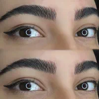 میکروبلیدینگ و شیدینگ لب