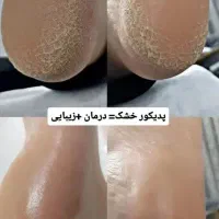 پدبکوروکفسابی|خدمات آرایشگری و زیبایی|قم, فرهنگیان و شهربانی|دیوار