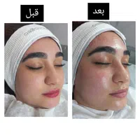 انجام انواع فیشال تخصصی پوست و انواع ماساژ بدن