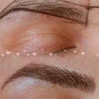 میکروبلیدینگ با روش‌های جدید