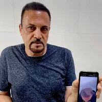 جشنواره کاشت مو ریش و ابرو|خدمات آرایشگری و زیبایی|اردبیل, |دیوار