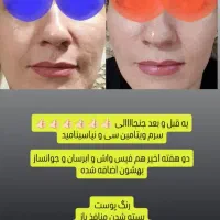 جوانساز|آرایشی، بهداشتی، درمانی|شیراز, ستارخان|دیوار