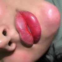 ژل بوتاکس سی سی ۵۰۰|خدمات آرایشگری و زیبایی|قرچک, میرزائی جنوبی|دیوار