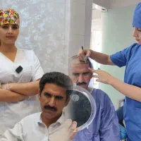 کاشت مو بین المللی