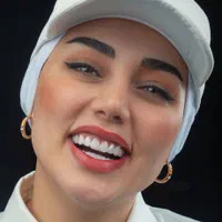 دندان کامپوزیت دندانپزشکی|خدمات آرایشگری و زیبایی|مشهد, دانشجو|دیوار