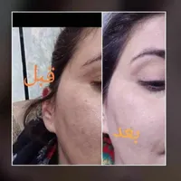 کرم وی آی پی (VIP) اصل|آرایشی، بهداشتی، درمانی|تهران, زعفرانیه|دیوار