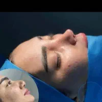 آف 30 درصدی جراحی بینی در اهواز