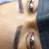 میکروبلیدینگ