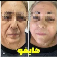 تخصصی هایفوهایفو تراپی پزشک(۱۲بعدی ۲۴بعدی ۳۶بعدی)