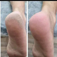 پدیکور و کفسابی با گارانتی|خدمات آرایشگری و زیبایی|اصفهان, سعادت‌آباد|دیوار