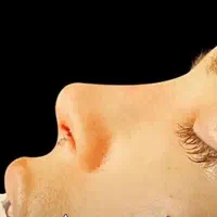 نوبت ویزیت و عمل بینی