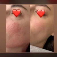 پاکسازی وفشیال تخصص آقا و خانم