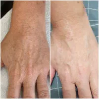 کفسابی پدیکور و رفع تیرگی تخفیف ب مدت ۲ روز|خدمات آرایشگری و زیبایی|فولادشهر, B2|دیوار