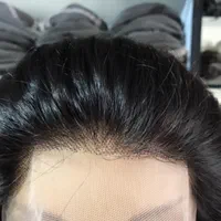 فروش پروتز مو،نصب پروتز مو،ترمیم پروتز مو،فروش چسب|آرایشی، بهداشتی، درمانی|رشت, گلسار|دیوار