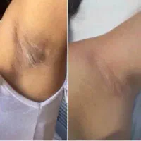 کرم رفع تیرگی تمام نقاط بدن|آرایشی، بهداشتی، درمانی|میناب, |دیوار