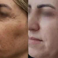 کاریابی درمنزل باگوشی.برای بانوان