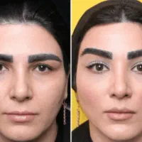 خدمات زیبایی و جوانسازی|خدمات آرایشگری و زیبایی|کرمانشاه, |دیوار