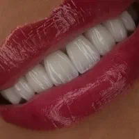 کامپوزیت دندان فکی ۵ ت اقساط لبه شیشه ای|خدمات آرایشگری و زیبایی|تهران, تهرانپارس جنوبی|دیوار