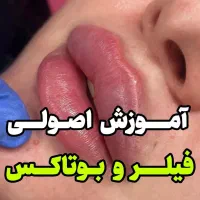 آموزش صفرتا۱۰۰ همه مباحث تزریق فیلر ژل بادی بوتاکس