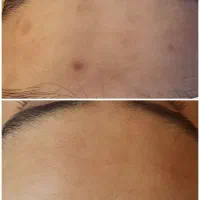 خدمات پوستی و فیشیال
