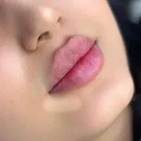 مدل برای انجام ژل و بوتاکس