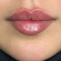 پروتزلب